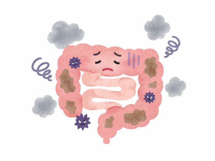 老廃物の蓄積と腸内環境の悪化を表す腸のイラスト